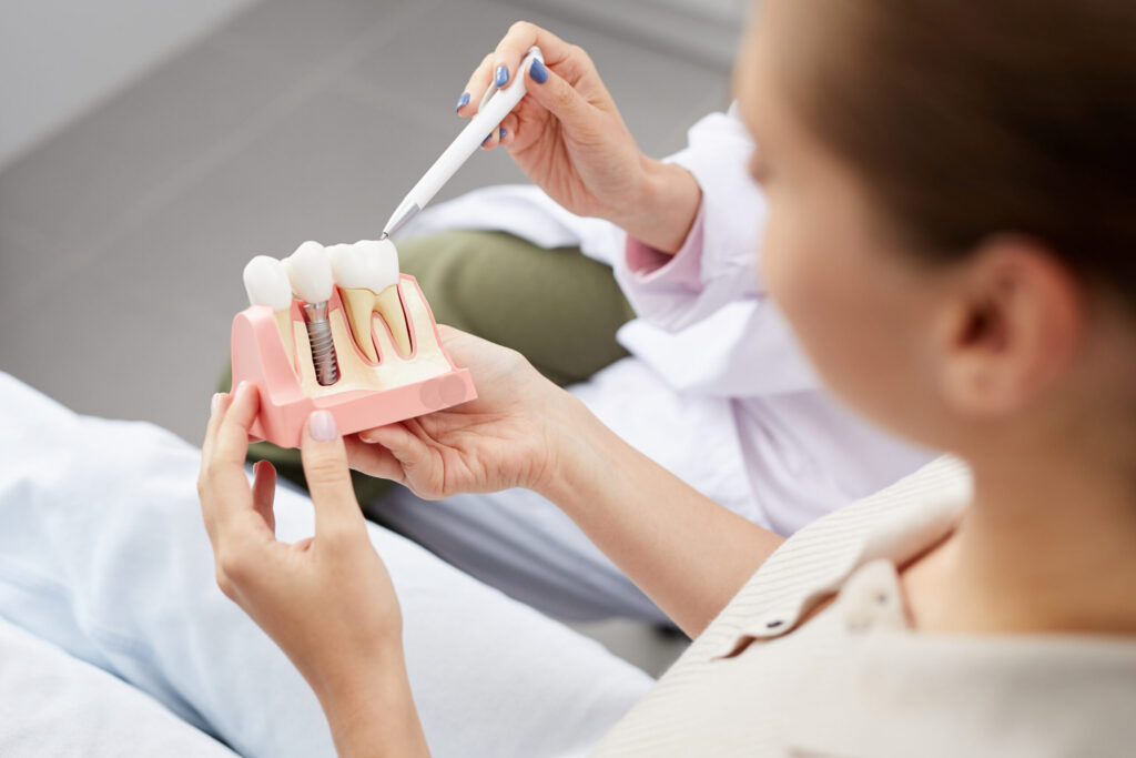 How Much Do Dental Implants Cost?