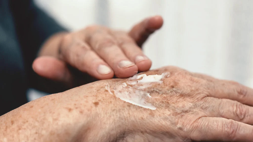 The best arthritis creams